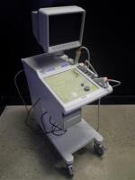 SHIMADZU SDU-400 ULTRASOUND MACHINE WITH 1 PROBE (5-8MHZ TRANSVERSE/SAGITTAL)