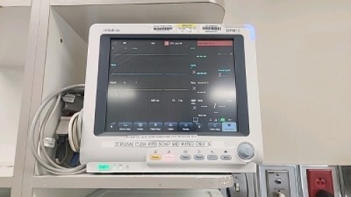 MINDRAY DPM 6 PATIENT MONITOR WITH MPM MODULE AND CABLES (ECG, SPO2, NIBP) LOCATED AT 1825 S. 43RD AVE SUITE B2 PHOENIX AZ 85009