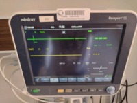 MINDRAY PASSPORT 12 PATIENT MONITOR WITH LEADS, WALL MOUNT
