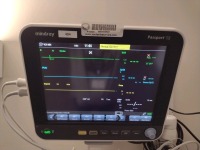 MINDRAY PASSPORT 12 PATIENT MONITOR WITH LEADS, WALL MOUNT