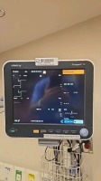 MINDRAY PASSPORT 12 PATIENT MONITOR WITH LEADS, WALL MOUNT
