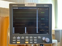 MINDRAY DATASCOPE PASSPORT V PATIENT MONITOR WITH LEADS, WALL MOUNT