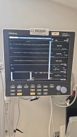MINDRAY DATASCOPE PASSPORT V PATIENT MONITOR WITH LEADS, WALL MOUNT