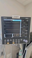 MINDRAY DATASCOPE PASSPORT V PATIENT MONITOR WITH LEADS, WALL MOUNT