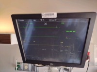 ELO TOUCH SOLUTIONS ET1928L-7CAM-1-BG-3-G 19" LCD TOUCH MONITOR