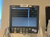 MINDRAY DATASCOPE PASSPORT V PATIENT MONITOR WITH LEADS, WALL MOUNT XX