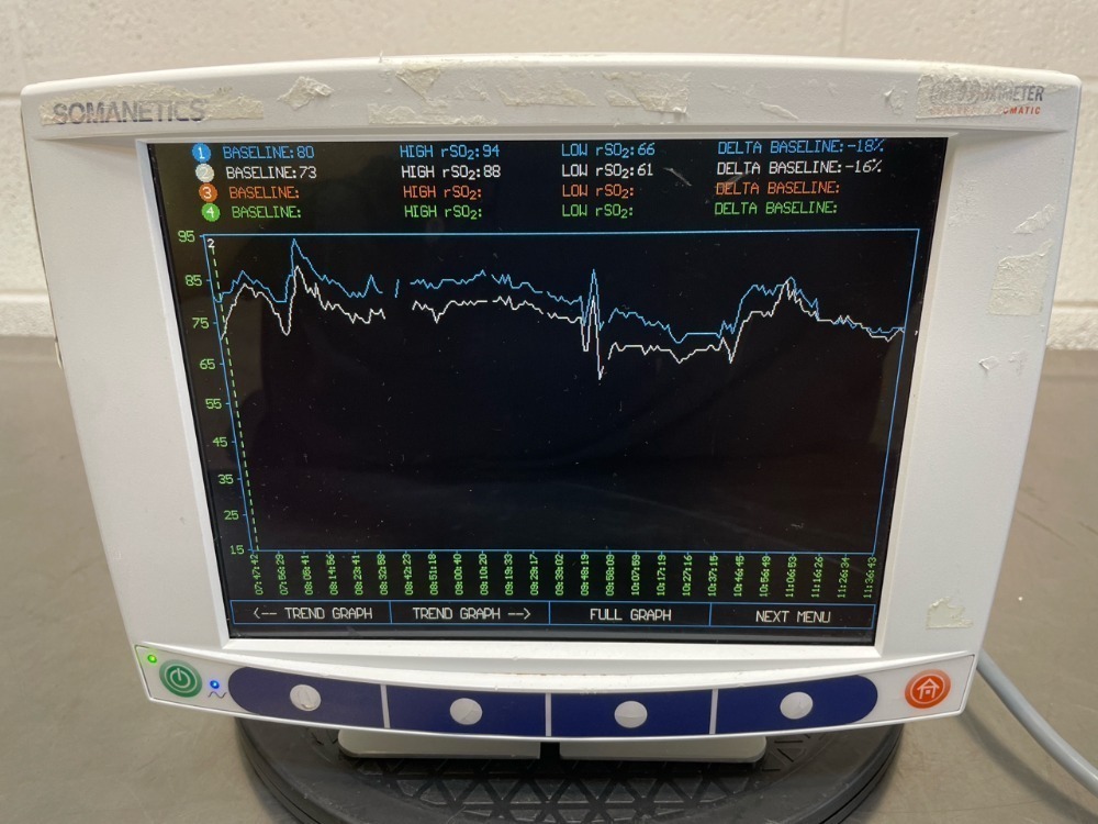 Somanetics Machine SOMANETICS INVOS CEREBAL OXIMETER PATIENT MONITOR