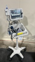 PHILIPS SURESIGN VS4 PATIENT MONITOR LOCATED AT 3325 MOUNT PROSPECT RD. FRANKLIN PARK, IL 60131