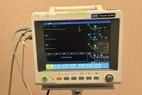 DRE WAVELINE EZ MAX, IM60 PATIENT MONITOR WITH PRINTER ON CART (located at 204 Gateway North Marble Falls, TX 78654)