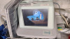 UNETIXS REVO VASCULAR DIAGNOSTIC SYSTEM - 2
