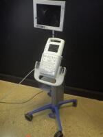 SONOSITE 180 PORTABLE ULTRASOUND MACHINE (SHATTERED DISPLAY MONITOR)