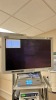 OLYMPUS 190 ENDOSCOPY TOWER SYSTEM TO INCLUDE: NDS CANDUCTOR, OLYMPUS OEP-5 DIGITAL COLOR PRINTER, OLYMPUS EVIS-EXERA III CV-190 VIDEO PROCESSOR, OLYMPUS EVIS EXERA III CLV-190 LIGHT SOURCE ON IDI CART - 9