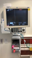 GE CDL1556A PATIENT MONITOR W/ GE MODULE RACK