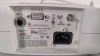 MASIMO RAD-87 PULSE OX - 2