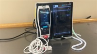 MASIMO ROOT MONITOR W/ RADICAL 7 PULSE OXIMETER LOCATED AT: LOCATED AT: 1 MEDICAL CENTER BLVD, CHESTER, PA 19013