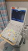 PHILIPS CX 50 ULTRASOUND SYSTEM W/ S5-1 AND T TRANSDUCERS AND SOFTWARE, DOM 10/17/2016, SNB1KGN5 LOCATED AT: LOCATED AT: 1 MEDICAL CENTER BLVD, CHESTER, PA 19013 2/ CENTRAL/ NON INVASIVE TEST ROOM - 5