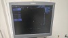 SIEMENS ACUSON S2000 ULTRASOUND SYSTEM W/14LS AND 4C1 TRANSDUCERS, DOM 01/2010, SN 202026 LOCATED AT: LOCATED AT: 1 MEDICAL CENTER BLVD, CHESTER, PA 19013 G/ XRAY/ OTS RM1 - 5