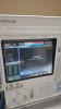 MINDRAY A7 ANESTHESIA SYSTEM, BUNDLE VERSION: 03.01.00 W/ MINDRAY PASSPORT 17M PATIENT MONITOR, T1 MONITOR, AG MODULE AND LEADS, SN A201704190160 LOCATED AT: LOCATED AT: 1 MEDICAL CENTER BLVD, CHESTER, PA 19013 4/OR 4 - 3