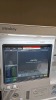 MINDRAY A7 ANESTHESIA SYSTEM, BUNDLE VERSION: 03.01.00 W/ MINDRAY PASSPORT 17M PATIENT MONITOR, T1 MONITOR, AG MODULE AND LEADS, SN A201704190176 LOCATED AT: LOCATED AT: 1 MEDICAL CENTER BLVD, CHESTER, PA 19013 4/OR 4 - 3