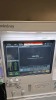 MINDRAY A7 ANESTHESIA SYSTEM, BUNDLE VERSION: 03.01.00 W/ MINDRAY PASSPORT 17M PATIENT MONITOR, T1 MONITOR W/ DOCKING STATION, AG, CCO/SVO2 AND QTY. (3) IBP MODULES , LEADS, SN A201611190082 LOCATED AT: LOCATED AT: 1 MEDICAL CENTER BLVD, CHESTER, PA 19013 - 3