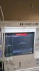 MINDRAY A7 ANESTHESIA SYSTEM, BUNDLE VERSION: 03.05.00 W/ MINDRAY PASSPORT 17M PATIENT MONITOR, T1 MONITOR, AG MODULE AND LEADS, SN A201611190060 LOCATED AT: LOCATED AT: 1 MEDICAL CENTER BLVD, CHESTER, PA 19013 4/OR 4 - 3