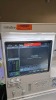MINDRAY A7 ANESTHESIA SYSTEM, BUNDLE VERSION: 03.01.00 W/ MINDRAY PASSPORT 17M PATIENT MONITOR, T1 MONITOR, AG MODULE AND LEADS, SN: A201611190063 LOCATED AT: LOCATED AT: 1 MEDICAL CENTER BLVD, CHESTER, PA 19013 - 3
