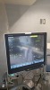 MINDRAY A7 ANESTHESIA SYSTEM, BUNDLE VERSION: 03.01.00 W/ MINDRAY PASSPORT 17M PATIENT MONITOR, T1 MONITOR W CO2 MODULE, AG MODULE AND DOCKING STATION, TANGENT MONITOR AND LEADS, SN A201704190010 LOCATED AT: LOCATED AT: 1 MEDICAL CENTER BLVD, CHESTER, PA - 2