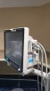 MINDRAY A7 ANESTHESIA SYSTEM, BUNDLE VERSION: 03.01.00 W/ MINDRAY PASSPORT 17M PATIENT MONITOR, T1 MONITOR, AG MODULE AND LEADS, SN A201704190160 LOCATED AT: LOCATED AT: 1 MEDICAL CENTER BLVD, CHESTER, PA 19013 4/OR 4 - 2