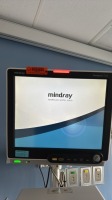 MINDRAY PASSPORT 17M PATIENT MONITOR W/ T1 MONITOR, BIS MODULE AND LEADS LOCATED AT: LOCATED AT: 1 MEDICAL CENTER BLVD, CHESTER, PA 19013 1/BURNUNIT/3