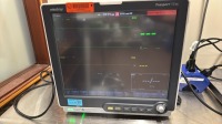 MINDRAY PASSPORT 17M PATIENT MONITOR W/ T1 MONITOR LOCATED AT: LOCATED AT: 1 MEDICAL CENTER BLVD, CHESTER, PA 19013