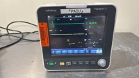 MINDRAY PASSPORT 8 PATIENT MONITOR W/CO2 MODULE LOCATED AT: LOCATED AT: 1 MEDICAL CENTER BLVD, CHESTER, PA 19013