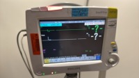 PHILIPS INTELLIVUE MP30 PATIENT MONITOR W/M3001A MODULE AND LEADS ON ROLLING STAND LOCATED AT: LOCATED AT: 1 MEDICAL CENTER BLVD, CHESTER, PA 19013