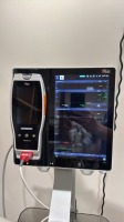 MASIMO ROOT MONITOR W/ RADICAL 7 PULSE OXIMETER ON ROLLING STAND LOCATED AT: LOCATED AT: 1 MEDICAL CENTER BLVD, CHESTER, PA 19013 3/MC HALLWAY
