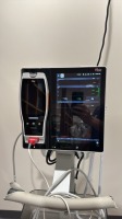MASIMO ROOT MONITOR W/ RADICAL 7 PULSE OXIMETER ON ROLLING STAND LOCATED AT: LOCATED AT: 1 MEDICAL CENTER BLVD, CHESTER, PA 19013 3/MC HALLWAY