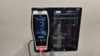 MASIMO ROOT MONITOR W/ RADICAL 7 PULSE OXIMETER ON ROLLING STAND LOCATED AT: LOCATED AT: 1 MEDICAL CENTER BLVD, CHESTER, PA 19013