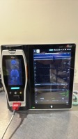 MASIMO ROOT MONITOR W/ RADICAL 7 PULSE OXIMETER LOCATED AT: LOCATED AT: 1 MEDICAL CENTER BLVD, CHESTER, PA 19013 1/WW/AF1217