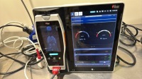 MASIMO ROOT MONITOR W/ RADICAL 7 PULSE OXIMETER LOCATED AT: LOCATED AT: 1 MEDICAL CENTER BLVD, CHESTER, PA 19013 1/WW/AF1217