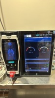 MASIMO ROOT MONITOR W/ RADICAL 7 PULSE OXIMETER, AC LOCATED AT: LOCATED AT: 1 MEDICAL CENTER BLVD, CHESTER, PA 19013 1/WW/HALL