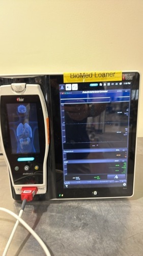 MASIMO ROOT MONITOR W/ RADICAL 7 PULSE OXIMETER, AC LOCATED AT: LOCATED AT: 1 MEDICAL CENTER BLVD, CHESTER, PA 19013 1/WW/HALL