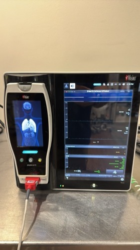 MASIMO ROOT MONITOR W/ RADICAL 7 PULSE OXIMETER, PC,PROBE LOCATED AT: LOCATED AT: 1 MEDICAL CENTER BLVD, CHESTER, PA 19013 1/WW/HALL