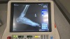 SIEMENS MOBILETT MIRA MAX, 10594738 MOBILE X-RAY VERSION. VE10S, SN: 1322 W/ MAX WI DETECTOR LOCATED AT: LOCATED AT: 1 MEDICAL CENTER BLVD, CHESTER, PA 19013 G/INT RAD - 9