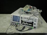 GE 250 SERIES FETAL MONITOR WITH CABLES (FECG/MECG, SPO2, NIBP, US1/US2, UA)