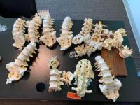 LOT OF ASSORTED SPINE MODELS AND STANDS