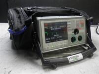 ZOLL E-SERIES BIPHASIC DEFIB WITH PACING, 12 LEAD ECG, ANALYZE, CO2, SPO2, NIBP & ECG CABLES