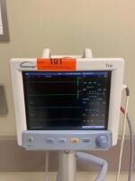 DATASCOPE TRIO PATIENT MONITOR ON CART