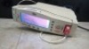 MASIMO RADICAL 7 PULSE OX WITH SPO2 CABLE