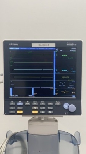 MINDRAY PASSPORT V PATIENT MONITOR ON CART