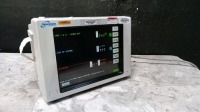SPACELABS 90369 PATIENT MONITOR