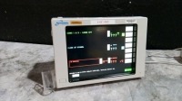 SPACELABS 90369 PATIENT MONITOR