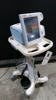 PHILIPS V60 VENTILATOR